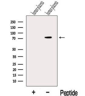 MAN1A2 Antibody - Western blot analysis of extracts of human placenta tissue using MAN1A2 antibody. The lane on the left was treated with blocking peptide.
