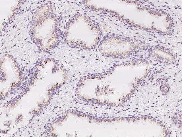 MAN1A2 Antibody - Immunochemical staining of human MAN1A2 in human prostate with rabbit polyclonal antibody at 1:100 dilution, formalin-fixed paraffin embedded sections.