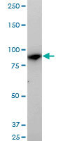 MAN1B1 Antibody - MAN1B1 monoclonal antibody (M01), clone 6B1. Western blot of MAN1B1 expression in LNCaP.