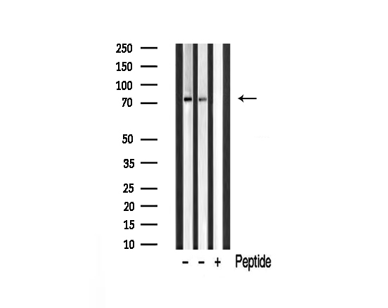 MAN1B1 Antibody - Western blot analysis of IKK-alpha/beta expression in mouse muscle tissue lysates. The lane on the right is treated with the antigen-specific peptide.