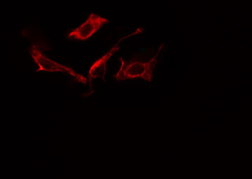 MAN1B1 Antibody - Staining NIH-3T3 cells by IF/ICC. The samples were fixed with PFA and permeabilized in 0.1% Triton X-100, then blocked in 10% serum for 45 min at 25°C. The primary antibody was diluted at 1:200 and incubated with the sample for 1 hour at 37°C. An Alexa Fluor 594 conjugated goat anti-rabbit IgG (H+L) antibody, diluted at 1/600, was used as secondary antibody.