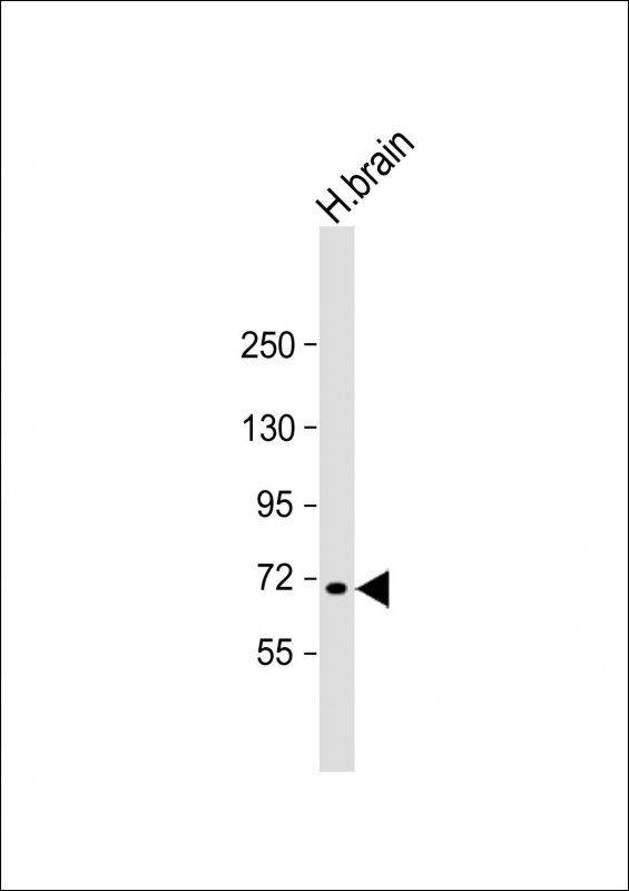 MAN1C1 Antibody - Anti-MAN1C1 Antibody (N-Term) at 1:2000 dilution + human brain lysate Lysates/proteins at 20 µg per lane. Secondary Goat Anti-Rabbit IgG, (H+L), Peroxidase conjugated at 1/10000 dilution. Predicted band size: 71 kDa Blocking/Dilution buffer: 5% NFDM/TBST.