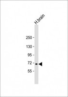 MAN1C1 Antibody - Anti-MAN1C1 Antibody (N-Term) at 1:2000 dilution + human brain lysate Lysates/proteins at 20 µg per lane. Secondary Goat Anti-Rabbit IgG, (H+L), Peroxidase conjugated at 1/10000 dilution. Predicted band size: 71 kDa Blocking/Dilution buffer: 5% NFDM/TBST.