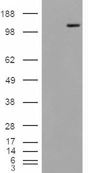 MAN2A1 / Mannosidase II Antibody - HEK293 overexpressing Man2A1 (RC220186) and probed with (mock transfection in first lane).