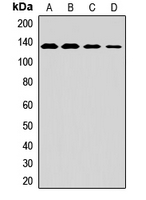 MAN2A1 / Mannosidase II Antibody