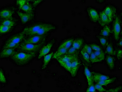 MAN2A1 / Mannosidase II Antibody - Immunofluorescent analysis of Hela cells diluted at 1:100 and Alexa Fluor 488-congugated AffiniPure Goat Anti-Rabbit IgG(H+L)