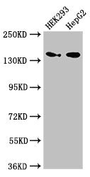 MAN2A1 / Mannosidase II Antibody - Western Blot Positive WB detected in:HEK293 whole cell lysate,HepG2 whole cell lysate All Lanes:MAN2A1 antibody at 3.5µg/ml Secondary Goat polyclonal to rabbit IgG at 1/50000 dilution Predicted band size: 132 KDa Observed band size: 150 KDa
