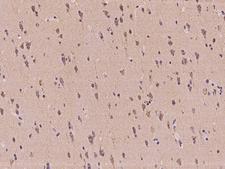 MAN2A2 / Alpha-Mannosidase II Antibody - Immunochemical staining of human MAN2A2 in human brain with rabbit polyclonal antibody at 1:100 dilution, formalin-fixed paraffin embedded sections.