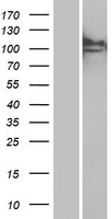 MAN2B1 / LAMAN Protein - Western validation with an anti-DDK antibody * L: Control HEK293 lysate R: Over-expression lysate