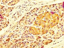 MAN2B2 Antibody - Immunohistochemistry image at a dilution of 1:100 and staining in paraffin-embedded human pancreatic tissue performed on a Leica BondTM system. After dewaxing and hydration, antigen retrieval was mediated by high pressure in a citrate buffer (pH 6.0) . Section was blocked with 10% normal goat serum 30min at RT. Then primary antibody (1% BSA) was incubated at 4 °C overnight. The primary is detected by a biotinylated secondary antibody and visualized using an HRP conjugated SP system.