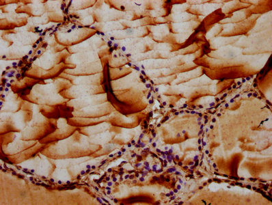 MAN2B2 Antibody - IHC image of MAN2B2 Antibody diluted at 1:100 and staining in paraffin-embedded human thyroid tissue performed on a Leica BondTM system. After dewaxing and hydration, antigen retrieval was mediated by high pressure in a citrate buffer (pH 6.0). Section was blocked with 10% normal goat serum 30min at RT. Then primary antibody (1% BSA) was incubated at 4°C overnight. The primary is detected by a biotinylated secondary antibody and visualized using an HRP conjugated SP system.