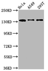 MAN2B2 Antibody - Western Blot Positive WB detected in: Hela whole cell lysate, A549 whole cell lysate, 293T whole cell lysate All lanes: MAN2B2 antibody at 1.4µg/ml Secondary Goat polyclonal to rabbit IgG at 1/50000 dilution Predicted band size: 114, 108 kDa Observed band size: 135 kDa