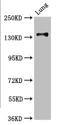MAN2B2 Antibody - Western Blot Positive WB detected in: Rat kidney tissue All lanes: MAN2B2 antibody at 3.4µg/ml Secondary Goat polyclonal to rabbit IgG at 1/50000 dilution Predicted band size: 114, 108 kDa Observed band size: 114 kDa