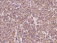 MAN2B2 Antibody - Immunochemical staining of human MAN2B2 in human pancreas with rabbit polyclonal antibody at 1:100 dilution, formalin-fixed paraffin embedded sections.