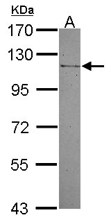 MAN2B2 Antibody - Sample (30 ug of whole cell lysate) A: A549 7.5% SDS PAGE MAN2B2 antibody diluted at 1:1000