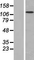 MAN2B2 Protein - Western validation with an anti-DDK antibody * L: Control HEK293 lysate R: Over-expression lysate