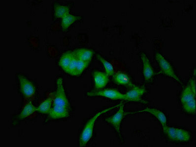 MAN2C1 Antibody - Immunofluorescent analysis of Hela cells using MAN2C1 Antibody at dilution of 1:100 and Alexa Fluor 488-congugated AffiniPure Goat Anti-Rabbit IgG(H+L)