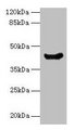 manA Antibody - Western blot All lanes: Mannose-6-phosphate isomerase antibody at 16µg/ml + DH5 alpha whole cell lysate Secondary Goat polyclonal to rabbit IgG at 1/10000 dilution Predicted band size: 43 kDa Observed band size: 43 kDa