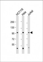 MANBA Antibody - All lanes: Anti-MANBA Antibody (C-Term) at 1:2000 dilution Lane 1: HCT116 whole cell lysate Lane 2: Hela whole cell lysate Lane 3: Jurkat whole cell lysate Lysates/proteins at 20 µg per lane. Secondary Goat Anti-Rabbit IgG, (H+L), Peroxidase conjugated at 1/10000 dilution. Predicted band size: 101kDa Blocking/Dilution buffer: 5% NFDM/TBST.