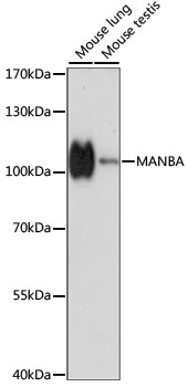 MANBA Antibody - Western blot analysis of extracts of various cell lines, using MANBA antibody at 1:1000 dilution. The secondary antibody used was an HRP Goat Anti-Rabbit IgG (H+L) at 1:10000 dilution. Lysates were loaded 25ug per lane and 3% nonfat dry milk in TBST was used for blocking. An ECL Kit was used for detection and the exposure time was 30s.