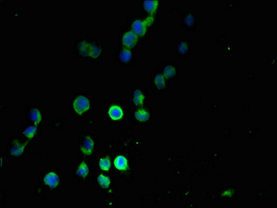 MANBAL Antibody - Immunofluorescent analysis of 293T cells using MANBAL Antibody at dilution of 1:100 and Alexa Fluor 488-congugated AffiniPure Goat Anti-Rabbit IgG(H+L)