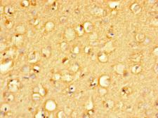 MANBAL Antibody - Immunohistochemistry of paraffin-embedded human brain tissue using MANBAL Antibody at dilution of 1:100