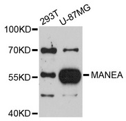 MANEA / ENDO Antibody - Western blot analysis of extracts of various cell lines, using MANEA antibody at 1:1000 dilution. The secondary antibody used was an HRP Goat Anti-Rabbit IgG (H+L) at 1:10000 dilution. Lysates were loaded 25ug per lane and 3% nonfat dry milk in TBST was used for blocking. An ECL Kit was used for detection and the exposure time was 90s.