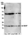 MANF / ARMET Antibody - Detection of human and mouse MANF by western blot. Samples: Whole cell lysate (15 µg) from HeLa, HEK293T, Jurkat, mouse TCMK-1, and mouse NIH 3T3 cells prepared using NETN lysis buffer. Antibody: Affinity purified rabbit anti-MANF antibody used for WB at 0.1 µg/ml. Detection: Chemiluminescence with an exposure time of 3 minutes.