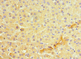 MANF / ARMET Antibody - Immunohistochemistry of paraffin-embedded human liver tissue using MANF Antibody at dilution of 1:100