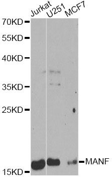 MANF / ARMET Antibody - Western blot analysis of extracts of various cell lines, using MANF Antibody at 1:1000 dilution. The secondary antibody used was an HRP Goat Anti-Rabbit IgG (H+L) at 1:10000 dilution. Lysates were loaded 25ug per lane and 3% nonfat dry milk in TBST was used for blocking. An ECL Kit was used for detection and the exposure time was 60s.