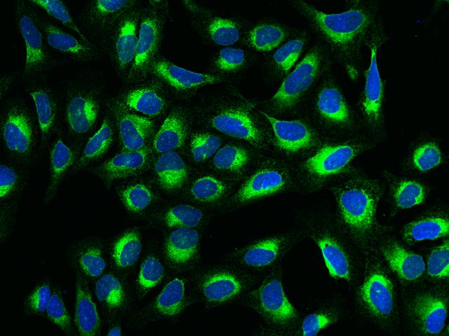 MANF / ARMET Antibody - Immunofluorescence staining of MANF in U2OS cells. Cells were fixed with 4% PFA, permeabilzed with 0.1% Triton X-100 in PBS, blocked with 10% serum, and incubated with rabbit anti-Human MANF polyclonal antibody (dilution ratio 1:500) at 4°C overnight. Then cells were stained with the Alexa Fluor 488-conjugated Goat Anti-rabbit IgG secondary antibody (green) and counterstained with DAPI (blue). Positive staining was localized to Cytoplasm.