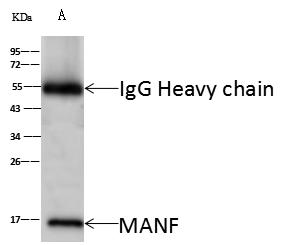 MANF / ARMET Antibody - MANF was immunoprecipitated using: Lane A: 0.5 mg 293T Whole Cell Lysate. 4uL anti-MANF rabbit polyclonal antibody and 60 ug of Immunomagnetic beads Protein A/G. Primary antibody: Anti-MANF rabbit polyclonal antibody, at 1:100 dilution. Secondary antibody: Goat Anti-Rabbit IgG (H+L)/HRP at 1/10000 dilution. Developed using the ECL technique. Performed under reducing conditions. Predicted band size: 21 kDa. Observed band size: 17 kDa.