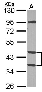 Mannose Phosphate Isomerase Antibody - Sample (30 ug of whole cell lysate). A: NT2D1. 10% SDS PAGE. MPI / PMI1 antibody diluted at 1:1000.