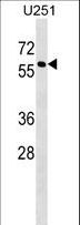 Mannose Phosphate Isomerase Antibody - MPI Antibody western blot of U251 cell line lysates (35 ug/lane). The MPI antibody detected the MPI protein (arrow).