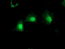 Mannose Phosphate Isomerase Antibody - Anti-MPI mouse monoclonal antibody immunofluorescent staining of COS7 cells transiently transfected by pCMV6-ENTRY MPI.