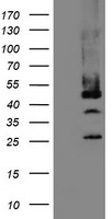 Mannose Phosphate Isomerase Antibody - HEK293T cells were transfected with the pCMV6-ENTRY control (Left lane) or pCMV6-ENTRY MPI (Right lane) cDNA for 48 hrs and lysed. Equivalent amounts of cell lysates (5 ug per lane) were separated by SDS-PAGE and immunoblotted with anti-MPI.