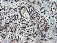 Mannose Phosphate Isomerase Antibody - IHC of paraffin-embedded Human breast tissue using anti-MPI mouse monoclonal antibody.