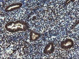 Mannose Phosphate Isomerase Antibody - IHC of paraffin-embedded Human endometrium tissue using anti-MPI mouse monoclonal antibody.