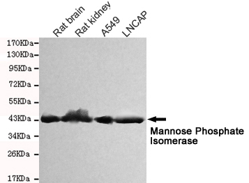 Mannose Phosphate Isomerase Antibody - Western blot detection of Mannose Phosphate Isomerase in Rat kidney, Rat brain, A549 and Lncap cell lysates and using Mannose Phosphate Isomerase mouse monoclonal antibody (1:1000 dilution). Predicted band size: 54KDa. Observed band size: 45KDa.