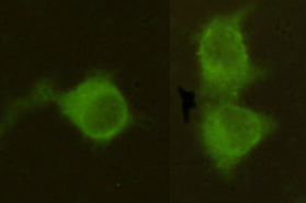 Mannose Phosphate Isomerase Antibody - Immunocytochemistry stain of HeLa using Mannose Phosphate Isomerase mouse monoclonal antibody (1:300).