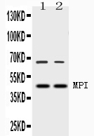 Mannose Phosphate Isomerase Antibody - Western blot - Anti-MPI Picoband Antibody