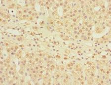 Mannose Phosphate Isomerase Antibody - Immunohistochemistry of paraffin-embedded human adrenal gland tissue at dilution 1:100