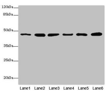 Mannose Phosphate Isomerase Antibody - Western blot All Lanes: MPIantibody at 5.12ug/ml Lane 1 : Mouse heart tissue Lane 2 : Mouse kidney tissue Lane 3 : Mouse brain tissue Lane 4 : HepG-2 whole cell lysate Lane 5 : 293T whole cell lysate Lane 6 : A549 whole cell lysate Secondary Goat polyclonal to Rabbit IgG at 1/10000 dilution Predicted band size: 47,40 kDa Observed band size: 47 kDa