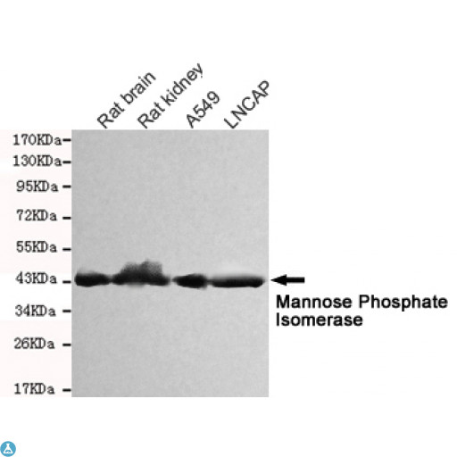 Mannose Phosphate Isomerase Antibody - Western blot detection of Mannose Phosphate Isomerase in Rat kidney, Rat brain, A549 and Lncap cell lysates and using Mannose Phosphate Isomerase mouse mAb (1:1000 diluted). Predicted band size: 54KDa. Observed band size: 45KDa.