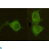 Mannose Phosphate Isomerase Antibody - Immunocytochemistry stain of Hela using Mannose Phosphate Isomerase mouse mAb (1:300).