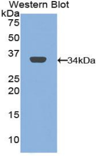 Mannose Receptor / CD206 Antibody - Western blot of recombinant Mannose Receptor / CD206.  This image was taken for the unconjugated form of this product. Other forms have not been tested.