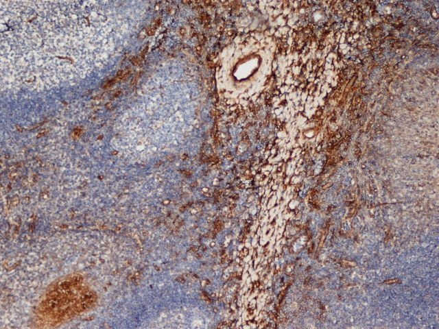Mannose Receptor / CD206 Antibody - Staining of frozen Human Tonsil stained with Mouse anti Human CD206.