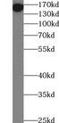 Mannose Receptor / CD206 Antibody - Human liver tissue were subjected to SDS PAGE followed by western blot with CD206 antibody at dilution of 1:2000