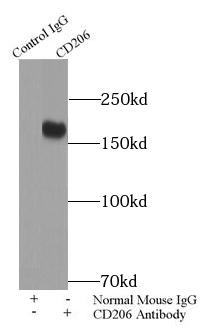 Mannose Receptor / CD206 Antibody - Result of anti-CD206 (IP: anti-CD206 antibody 5ug; Detection: anti-CD206 antibody 1:500) with human placenta tissue lysate 1400ug.