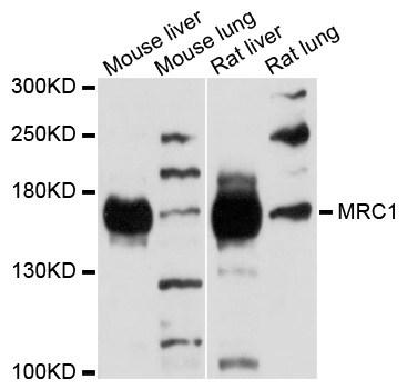 Mannose Receptor / CD206 Antibody - Western blot analysis of extracts of various cells.